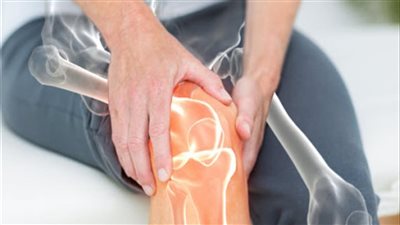 خبيرة تغذية: هذا سبب الإصابة بهشاشة العظام 