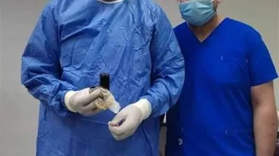صور.. استخراج هاتف محمول من بطن مريض بمستشفى بنها الجامعي