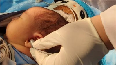 الصحة: فحص 4 مليون و263 ألف طفل ضمن مبادرة 