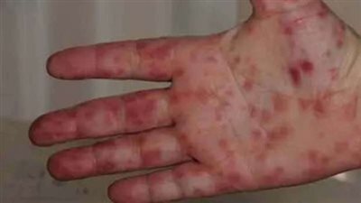 أول تعليق من 