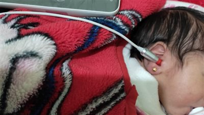 فحص 310 آلاف طفل منذ بدء المبادرة الرئاسية للكشف ضعاف السمع