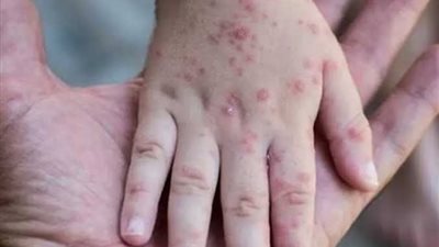 رغم عدم رصده.. عوض تاج الدين يكشف استعدادات مصر لمواجهة 