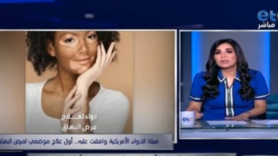 بعد موافقة هيئة الدواء الأمريكية عليه.. هاني الناظر: ثمن العلاج 36 ألف جنيه