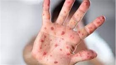 باحث في الفيروسات يكشف تفاصيل تسجيل أول حالة وفاة بـ 