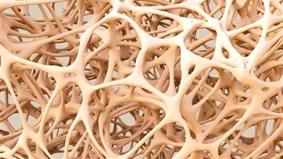 ما هو مرض هشاشة العظام وأسبابه وعلاجه؟