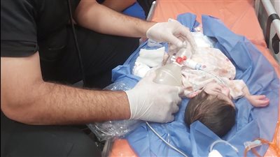  عبدالغفار يتابع الحالة الصحية للطفل «سليم» بعد نقله إلى مصر بطائرة طبية