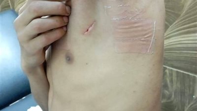 القبض على المتهمين بالتعدي على طفل وتمزيق جسده بالقليوبية