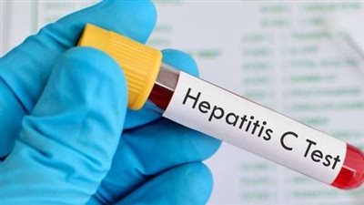 وحدة زراعة الكبد: فيروس سي كان فزاعة للمصريين.. والمريض أصبح مطمئنا (فيديو)