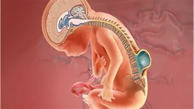 مصابة به طفلة ناحية من حريق الهانوفيل.. ماذا تعرف عن 