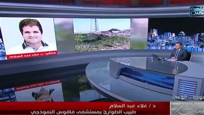 طبيب الشرقية: أحد أبنائي فقد الطحال والآخر يعاني نزيف داخلي بحادث الميكروباص