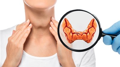 طبيب يوضح أهم أعراض الإصابة بتضخم الغدد الصماء (فيديو)