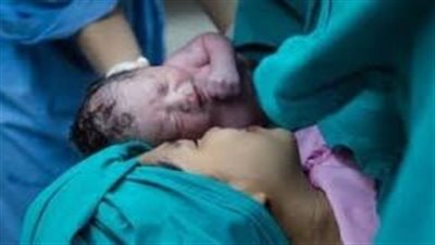 تعرف على مضاعفات الولادة القيصرية للأم والجنين