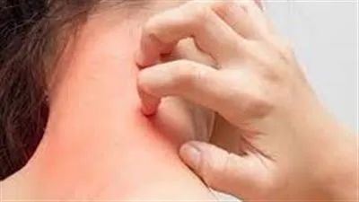 بعد تدهور حالة فريد الديب الصحية.. كل ما تريد معرفته عن مرض سرطان الدم