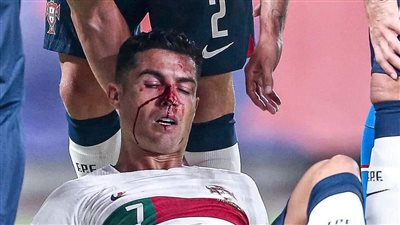 عاجل.. رونالدو يتعرض لإصابة قوية ضد التشيك بدوري الأمم الأوروبية 