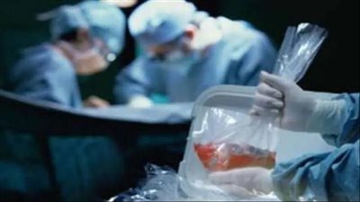 6 معلومات لا تعرفها عن مركز زراعة الأعضاء في مصر 