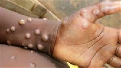 تصريح عاجل من 