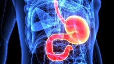 تعرف على أعراض وأسباب حموضة المعدة وطرق العلاج