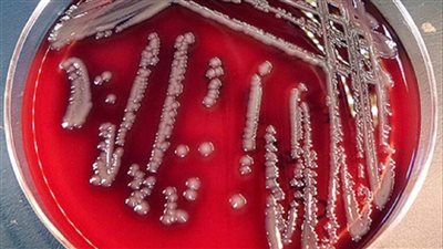 ظهور بكتيريا 