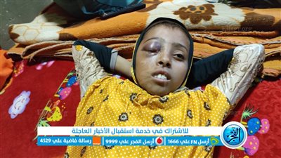  بسبب شاب متهور| تلميذة تفقد عينها اليمنى داخل فناء المدرسة بالفيوم.. وأسرتها عايزين حقها (فيديو) 