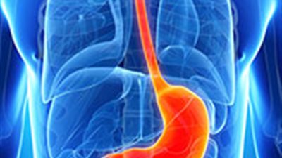 التهاب المعدة.. تعرف على أعراضه وأسبابه وطرق علاجه