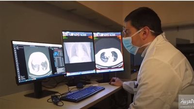 ظهور علامات للشيخوخة على الأطفال.. هل السبب إصابتهم بكورونا؟