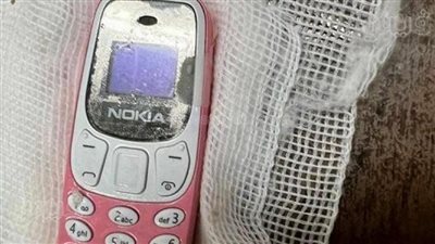 طبيب يكشف ملابسات استخراج هاتف من معدة شاب بمستشفى طنطا