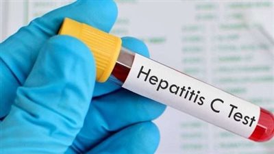استشاري كبد: مصابو فيروس سي أصبحوا أقل من 1% (فيديو)