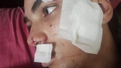 والد طالب ثانوي يتهم 3 أشخاص بإصابة نجله بـ 25 غرزة أثناء سرقته بشبرا الخيمة