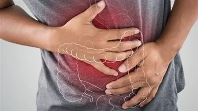 أستاذ جهاز هضمي: الإصابة بالسرطان بسبب جرثومة المعدة لا تتعدى 0.1%