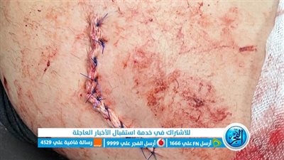 طعنهما بالمقص.. إصابة شقيقين على يد صاحب محل ورود بالمنوفية 