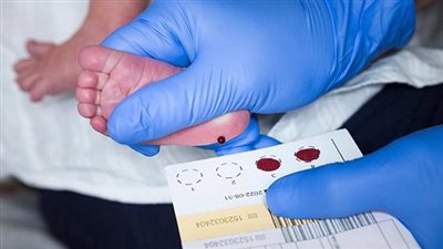 عوض تاج الدين: وزارة الصحة تأخذ عينة من كعب الطفل لهذا السبب