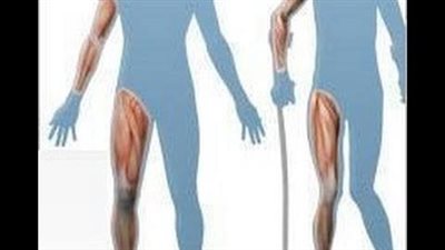 عميد كلية العلاج الطبيعي يوضح أسباب الإصابة بضمور العضلات