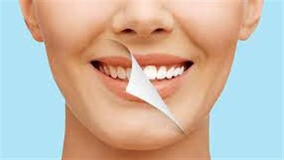 احصلي علي ابتسامة هوليوود دون تبييض الأسنان