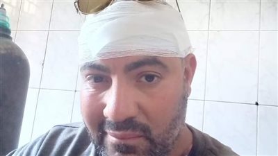 إصابة رئيس قرية أبومناع أثناء تنفيذ إزالة تعدٍ على أرض زراعية بدشنا 