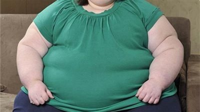 تعرف على مرض السمنة وأسبابه وطرق علاجه