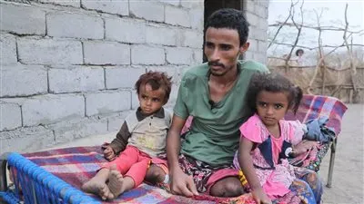 خدام علي.. قصة صياد يمني حولت الميليشيات الحوثية حياته إلى جحيم بسبب الألغام