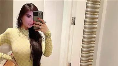 حقيقة وفاة كيم كارداشيان بسبب عملية جراحية معقدة 