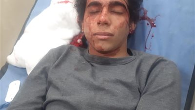 الأجهزة الأمنية تلقي القبض على متهمين هشموا رأس لاعب كرة ببورسعيد