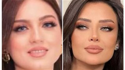 الحرب تشتعل من جديد بين ياسمين عز ورضوى الشربيني 