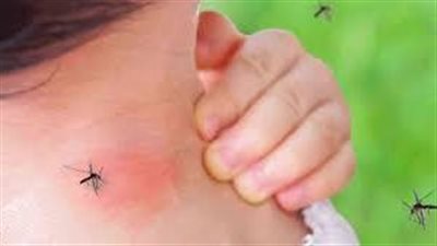 منهم الحوامل.. هؤلاء الأشخاص هم الأكثر جاذبية للبعوض