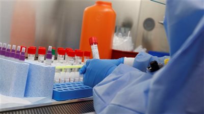 «الفجر» يجيب عن 6 تساؤلات حول متحور كورونا الجديد «إي جي.5» 