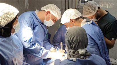 نجاح استئصال جزء من بنكرياس بسبب ورم بمستشفى سرس الليان بالمنوفية