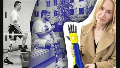 ضريبة الحرب.. أكثر من 50 ألف أوكراني في حاجة لأطراف صناعية