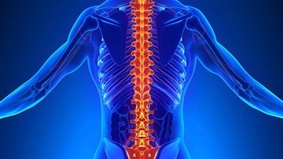 أستاذ جراحة مخ وأعصاب: نسبة الإصابة بالتحدب لدى الأطفال ارتفعت (فيديو)