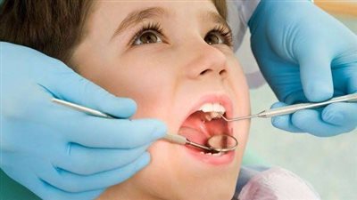 التهاب اللثة: فهم الأعراض والوقاية للحفاظ على صحة اللثة والأسنان