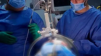 إجراء جراحة بالمخ لمريض بمستشفى جامعة طنطا لعلاج الوسواس القهري