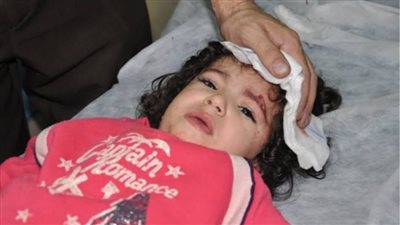 الدعاء لاطفال غزة الجرحى والمصابين..