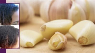 عجائب الثوم..مفتاح لشعر صحي وطويل