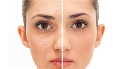 إليك افضل انواع ماسكات البشرة 