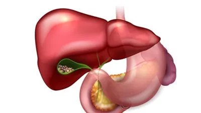نظام غذائي صحي لمرضى المرارة.. الأطعمة المفضلة والتوجيهات